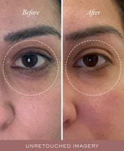 Sahajan Gold Glow Eye Balm
